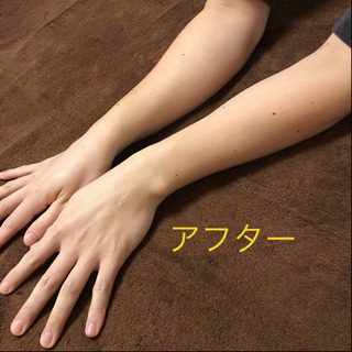 接客業種に人気のメンズ腕脱毛 - 地元のお店