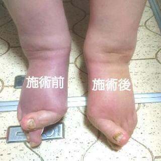 台湾式足つぼ - 足立区