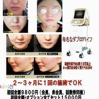 脂肪冷却、カッピング、ネトラバスティ　エステモニター色々募集中の画像