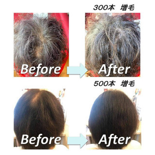 埼玉増毛エクステ【エアエク】女性の薄毛対策・髪のボリュームアップ...