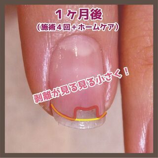 【爪のお悩み解消】≪剥離・デコボコ爪でお悩みの方に！！≫ネイルサロンで解消できる最強ケア - 美容
