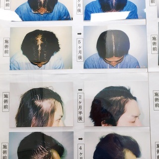 髪も生やして、自信も生やそう！