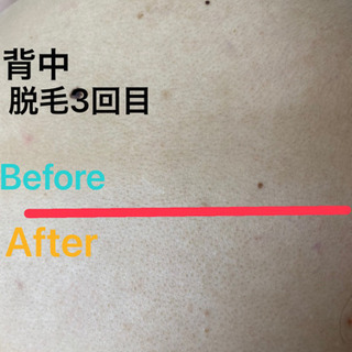 背中の産毛も撃退しよう🤭