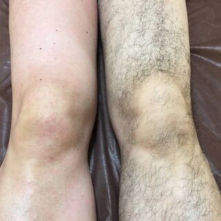 【四ツ谷三丁目 徒歩２分】男性限定メニュー  ワックス脱毛 リラクゼーションサロン - 新宿区