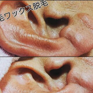 【四ツ谷三丁目 徒歩２分】男性限定メニュー 耳毛脱毛 サロン - 新宿区