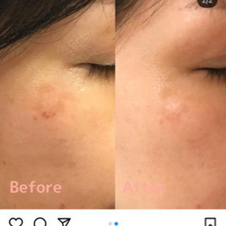 今大流行中のヒト臍帯血幹細胞美容液のサンプルプレゼント💕の画像