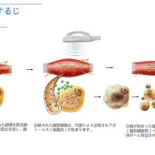 軽めの運動と最新の機械で効率よく痩せられます！！の画像