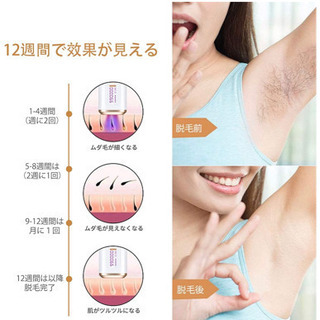(新品) レーザー 永久脱毛 IPL光脱毛器 全身対応 メンズ レディース 家庭用脱毛器 99万発照射回数 説明書付きプラグ式の画像