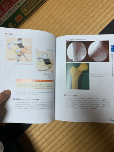 骨折　髄内固定治療マイスター　中古