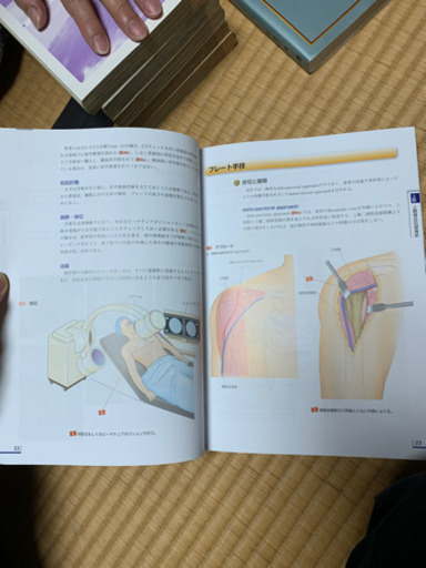 骨折　プレート治療マイスター　送料無料　中古