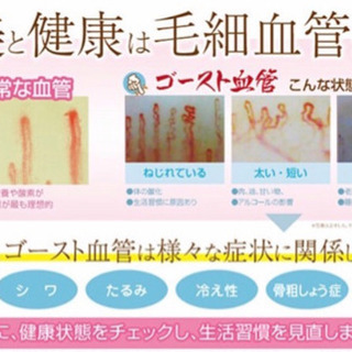 ⭐️６月６日(金)スッキリ解決‼️毛細血管から分かるイベント