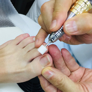 巻爪❗️矯正終了❗️様子見ましょう❗️ - ボディケア