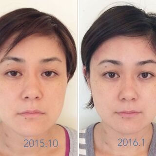 ☆顔ヨガ☆オンラインレッスン〔パーソナル専門・講師歴９年〕の画像