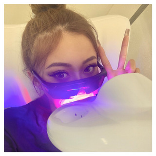 横浜で1番白くなる🦷無痛ホワイトニングサロン🦷✨2970円！