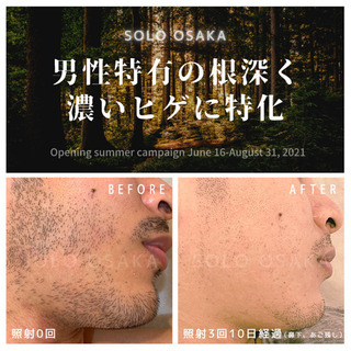 Before▶︎After - 岸和田市