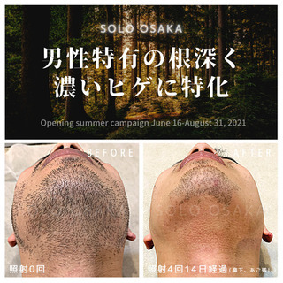 Before▶︎After