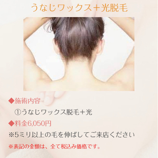 【うなじミックス脱毛】