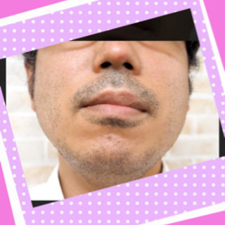 【　ひげ脱毛モニターさん】募集