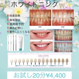 歯のセルフホワイトニング🦷✨