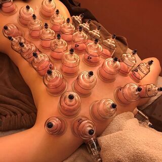 女性だけでなく男性にも大人気カッピング導入！モデル募集！今ならな...