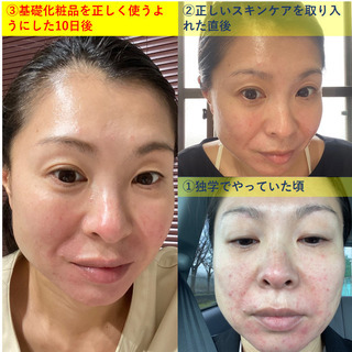 【長野】<スキンケア&メイクアップ>お肌のお悩み解決!美容相談会の画像