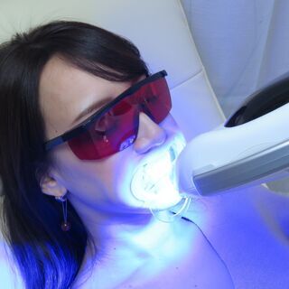 ホワイトニングの体験チケットお譲りします