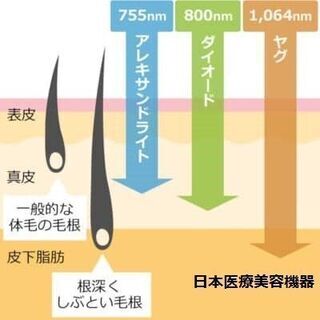 LED脱毛機（業務用ダイオードLED脱毛） 新品★唯一無二！光脱毛を超えた新世代脱毛機 メンズ、産毛に！2000万ショット！ロゴ表示可！★脱毛保険対応機器の画像