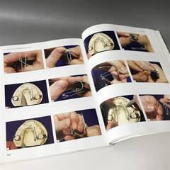 ⭕⭕⭕KY4/90 洋書 Les traitements orthodontiques prcoces 歯科 歴史 歯科学 歯科治療 矯正 臨床歯科 orthodontic⭕⭕⭕の画像