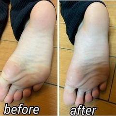 オンラインOK 足裏覚醒ケアの画像