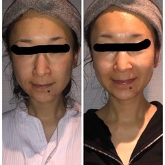 ✩.*˚フェイシャルエステ✩.*˚の画像