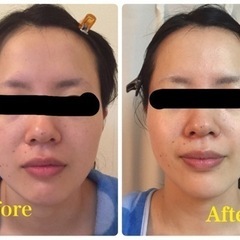 ✩.*˚フェイシャルエステ✩.*˚の画像