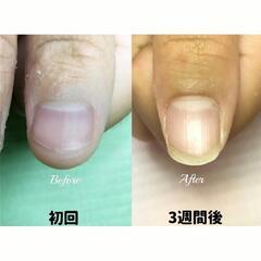 名古屋市緑区大高深爪ケア専門サロン❋ゼイネイル