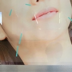 美容鍼モニター募集❗️本日12/16 午前中お一人様限定❗️