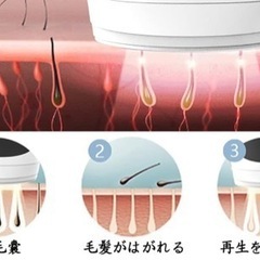 【新品】光美容レーザー脱毛器 美肌機能搭載 VIO対応 永久脱毛（2）の画像