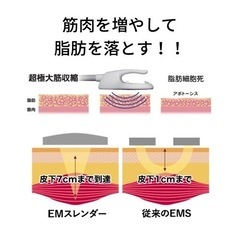 大人気痩身マシン！EMSの7倍！？エムスレンダースカルプトの画像