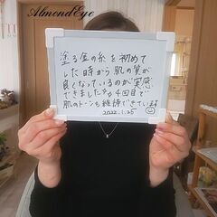ハーブピーリング