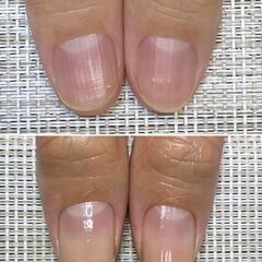 最強のネイルケア　モニター様募集