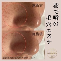 噂の毛穴エステ　沖縄/毛穴エクストラクション