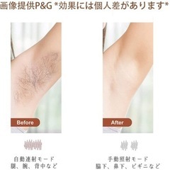 ❗️売却済み❗️脱毛器　（新品・未開封）の画像