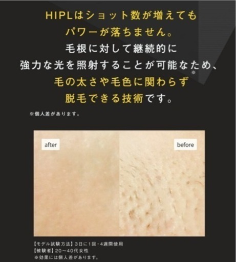 【新品未開封】脱毛器 JOVS Dora 次世代HIPL 冷却機能 小型軽量