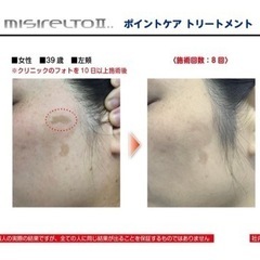 シミケア・肌質改善サロン