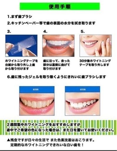 ホワイトニング　シート　14枚7日分×25箱　激安　