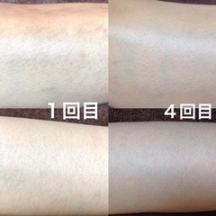 ︎ 【ジモティ限定脱毛モニター募集】⭐︎セルフ脱毛⭐︎初回2,000円