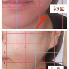 肌質ケア