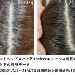 薄毛や白髪、ニキビにお悩みの方！マイスターのいる当サロンへ是非、...