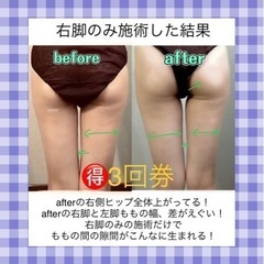 痩身足痩せ💜今だけお得‼️キャビテーション＋ラジオ波3回券 - 神戸市