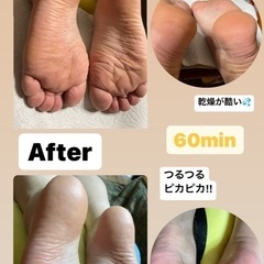🦶足の角質ケア4,400円🥰募集❣️❣️の画像