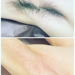 随時採用！脱毛サロンスタッフ募集！の画像