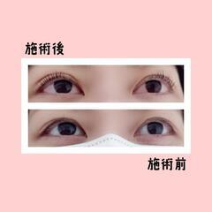 マツエク　ラッシュリフト　ココボーテ - 美容
