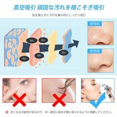 【特売36％OFF】ANLAN 毛穴吸引器 強力 小鼻 汚れ 角栓 黒ずみ 吸引 毛穴ケア 光エステの画像